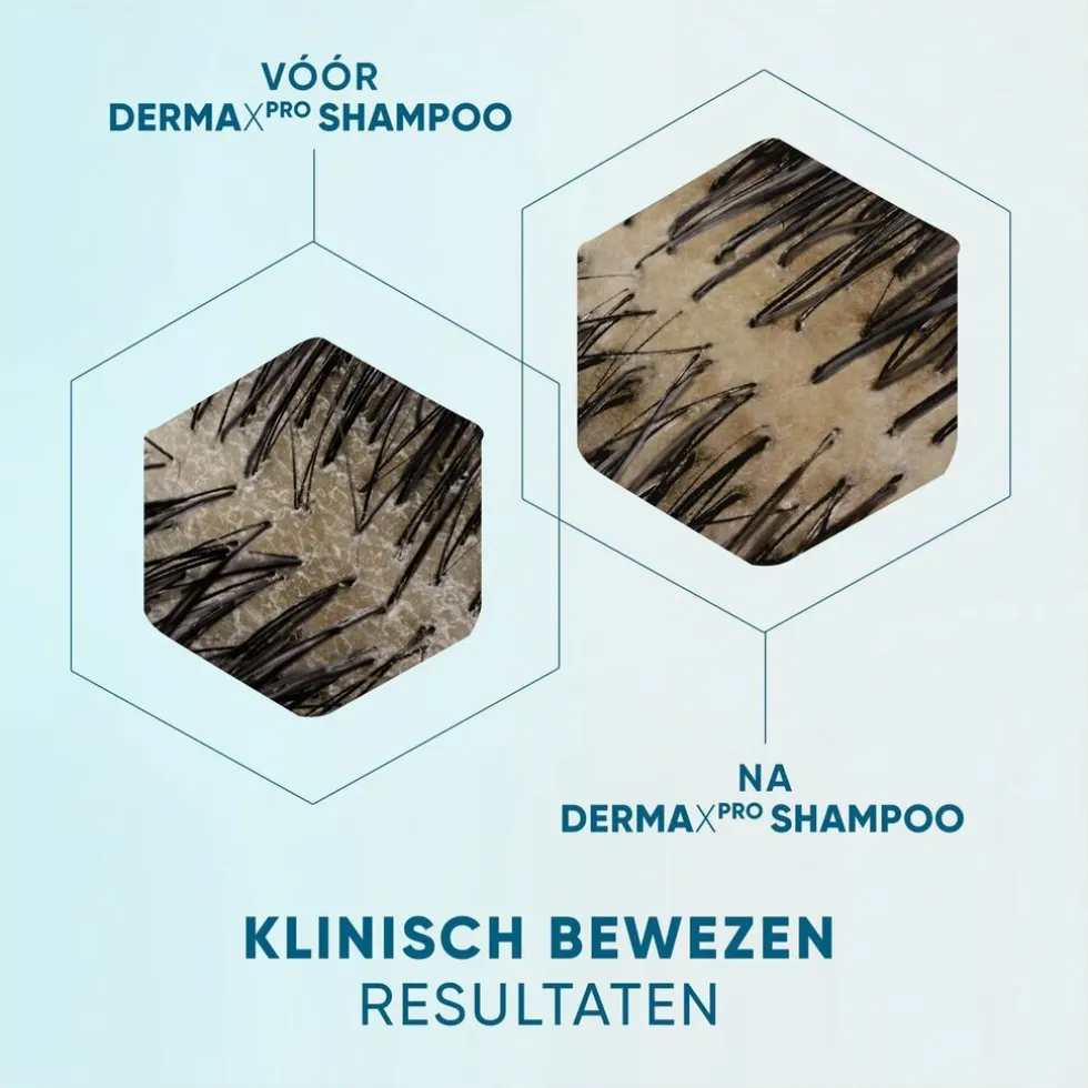 DermaXPro by Head & Shoulders Kalmeert Antiroosshampoo