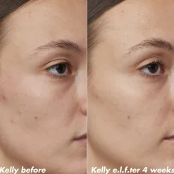 e.l.f. Skin PLZ Clarify Facial Oil
