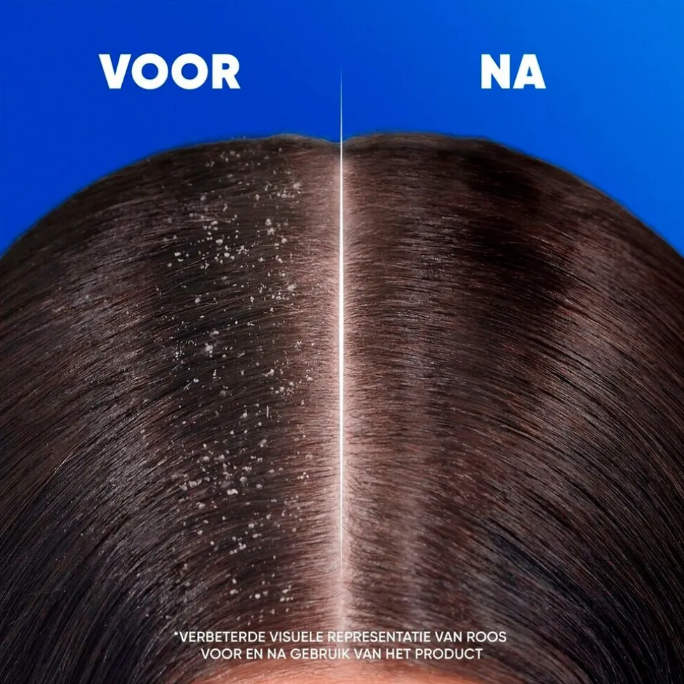 Head & Shoulders Anti-Haaruitval Antiroosshampoo