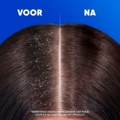 Head & Shoulders Apple Fresh 2-in-1 Antiroosshampoo