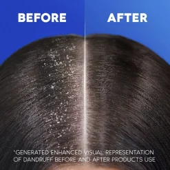 Head & Shoulders Classic Shampoo met Pomp
