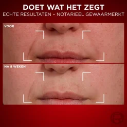L'Oréal Paris Revitalift Laser Anti-Rimpel Dagcrème