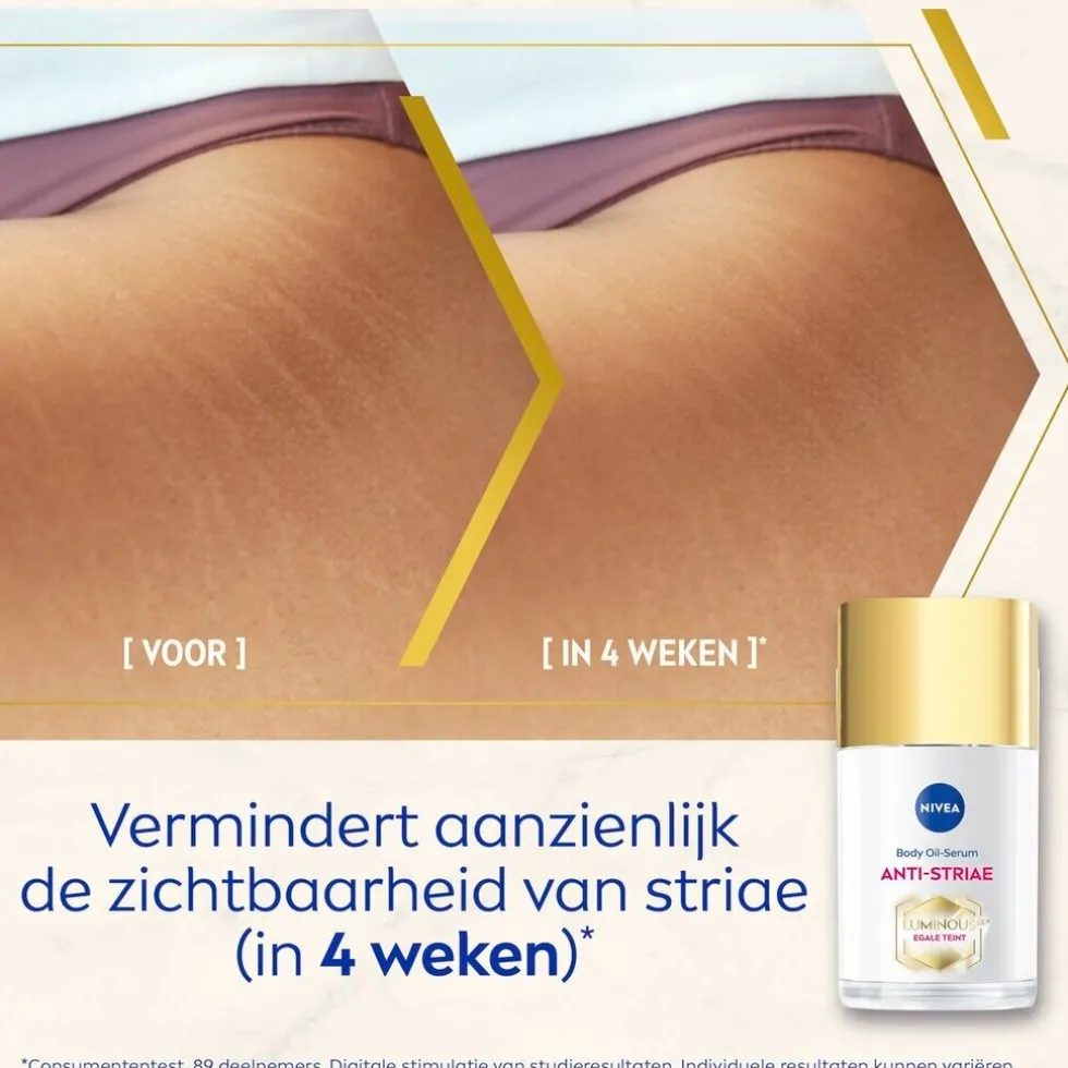 NIVEA Luminous630 Anti-Striae/Anti-Striemen Body Oil-Serum